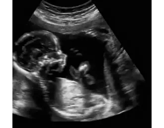 /Content/ServiceImages/bio-profile-scan (1).webp